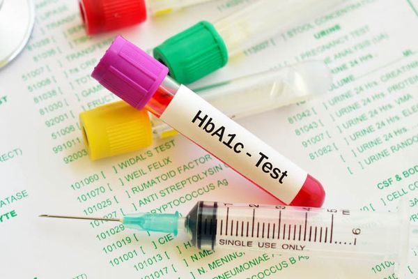 Cách thử tiểu đường tại nhà bằng xét nghiệm HbA1C